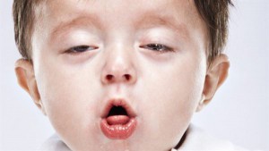 Gọi tên các biến chứng để biết bệnh hen suyễn có nguy hiểm không?