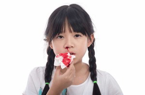 Bình tĩnh xử trí khi trẻ bị sổ mũi ra máu
